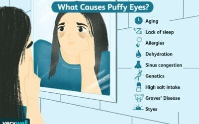 What Health Issues Cause Bags Under Eyes?