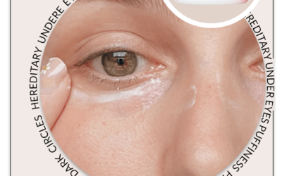 Which Vitamin Is Best For Eye Bags?