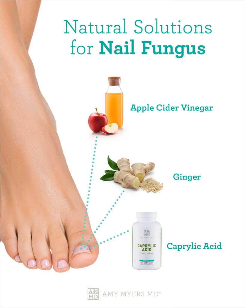 Effective Ways to Cure Nail Fungus Naturally