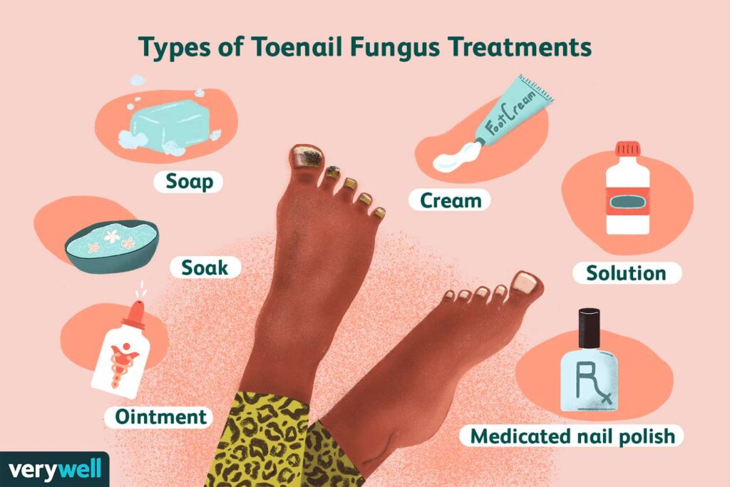 Effective Ways to Cure Nail Fungus Naturally