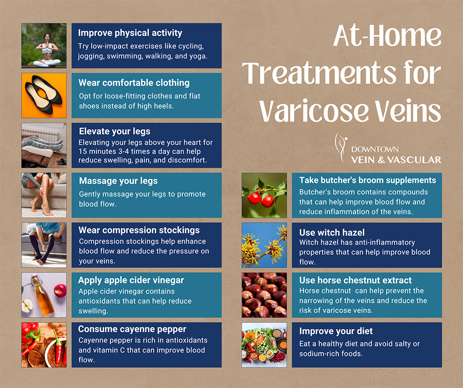 Preventing and Managing Varicose Veins Naturally